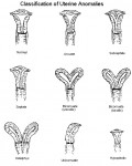 uterineanomalies