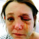battered-pregnant-woman