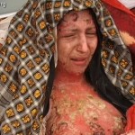 Indian Bride Burning