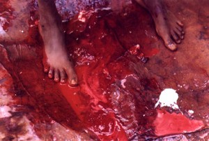 fgm