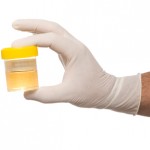 Urine Sample