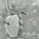 This image from a scanning electron microscope shows the upper leaf surface several nematodes (arrows), stalked glands, and adherent sand grains (arrows).  Image Rafael Oliveira PNAS