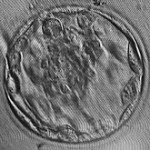 220px-Blastocyst